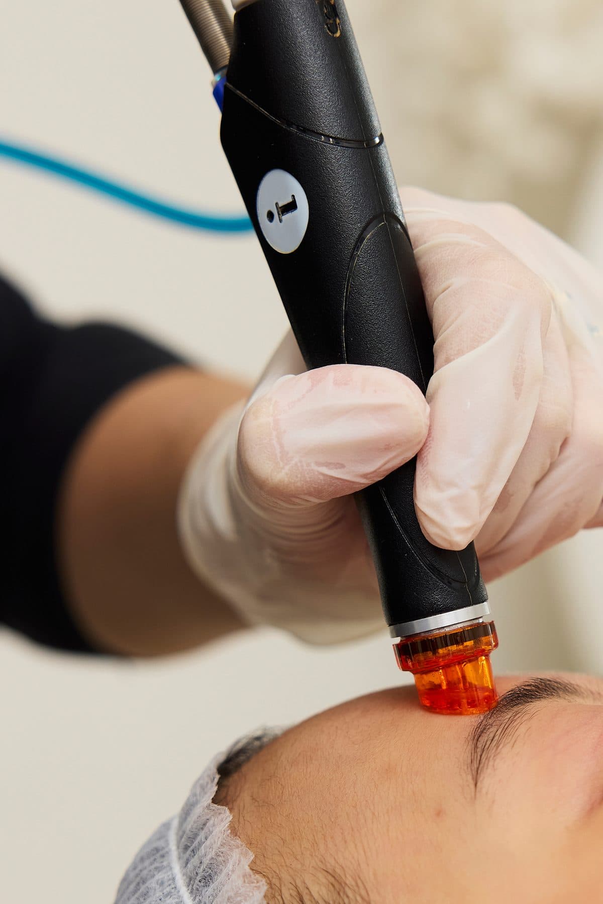 Het handstuk van de Dermapen 4 op de huid