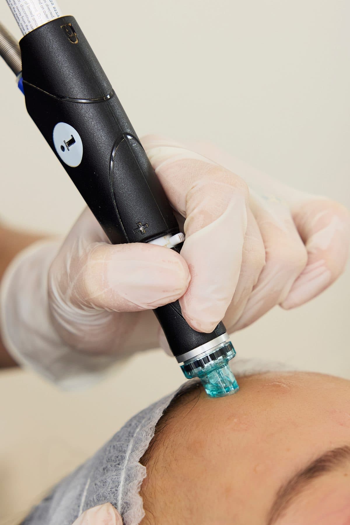 Het HydraFacial-mondstuk gaat over de wang
